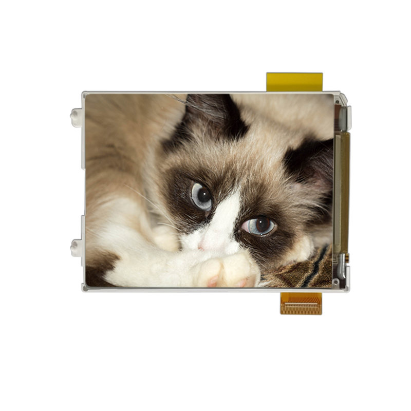 TFT Screen Module: Top Display Technology Innovations and Applications